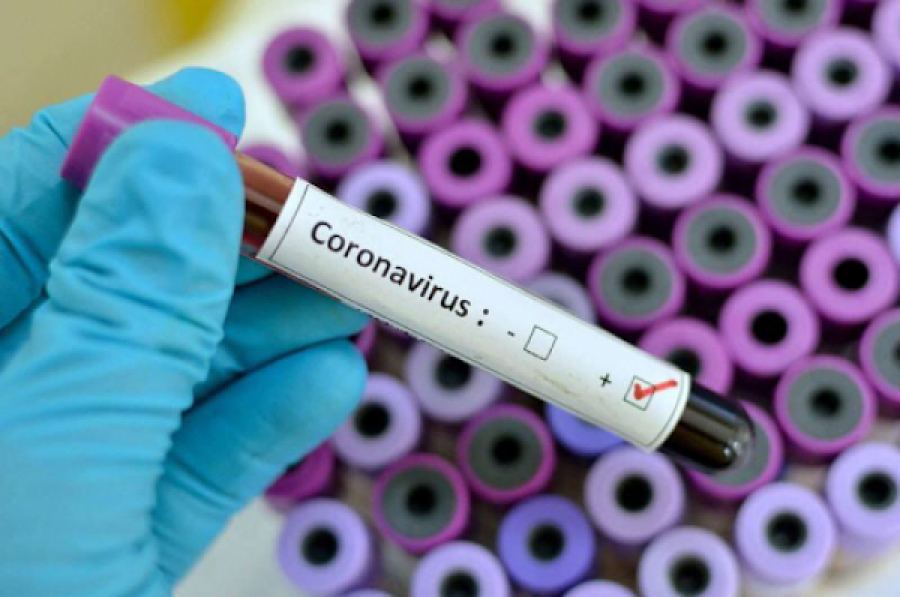 Өткен тәулікте 1076 адам коронавирустан емделіп шықты