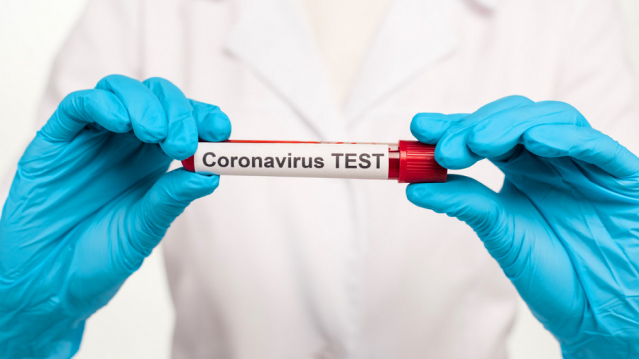 Қазақстанда өткен тәулікте 869 адамнан коронавирус анықталды