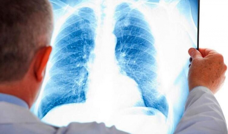 Пневмония с признаками КВИ: 10 заболевших и три смерти за сутки