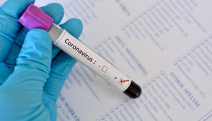 Қазақстанда өткен тәулікте 723 адам коронавирус індетінен жазылып шықты